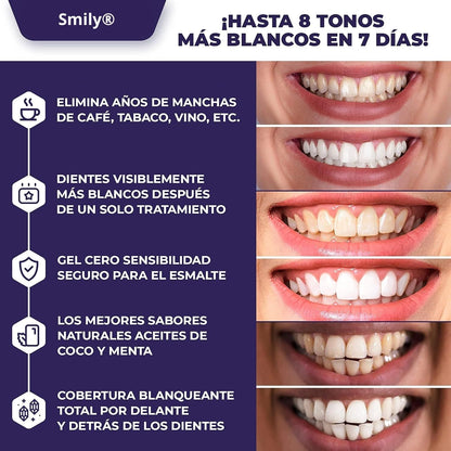 Tiras blanqueadoras Smily®